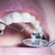 Temporary Dental Filling